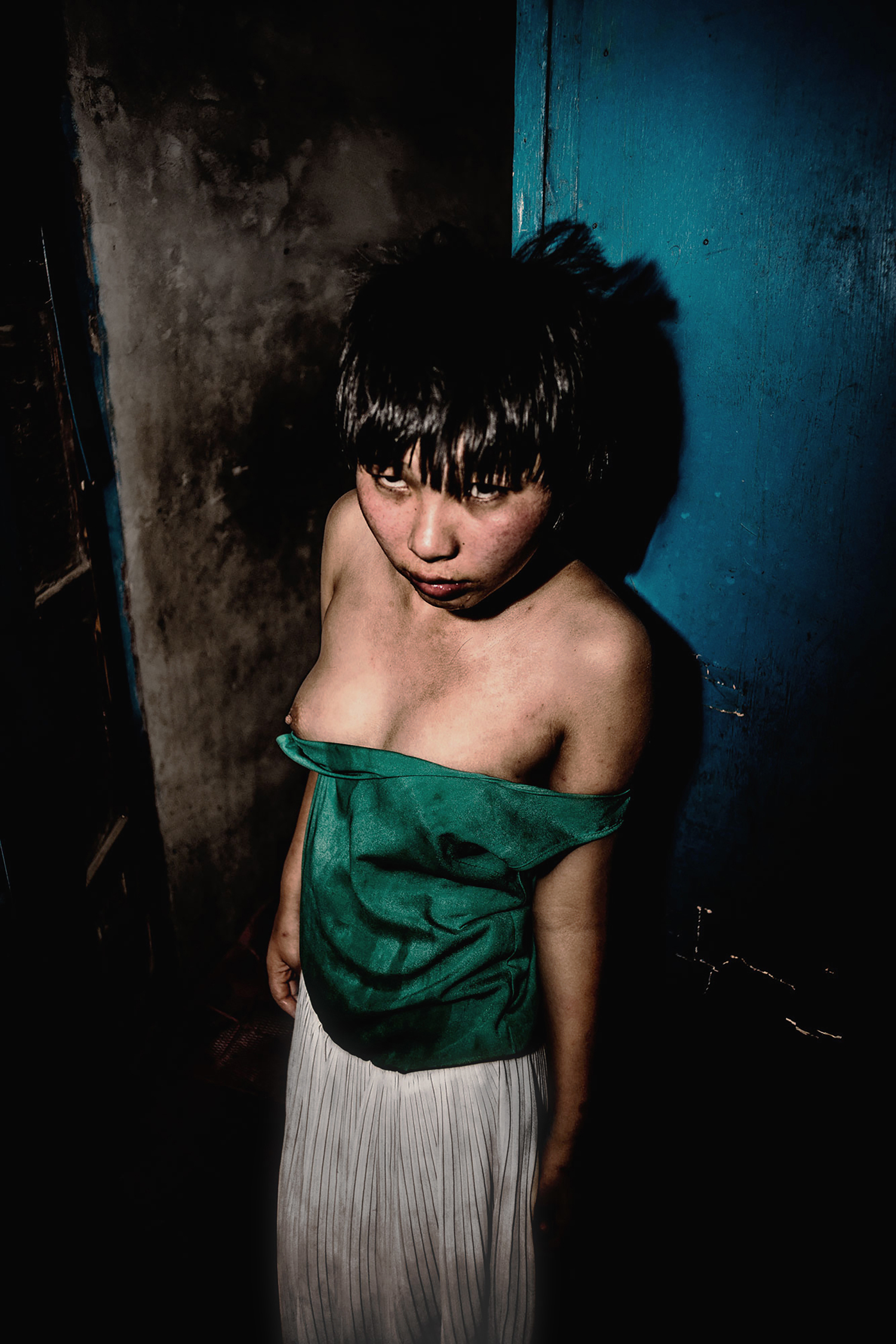 8 - A girl who has long been locked in the basement, 20 years old, schizophrenia. - 591dc9